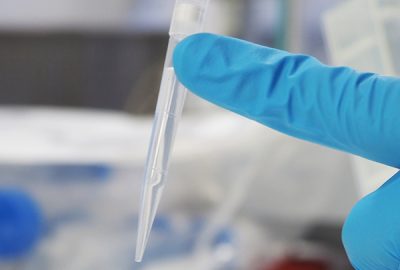 Pipette tip with clear liquid at centre of image, held in place by an index finger in a blue latex glove